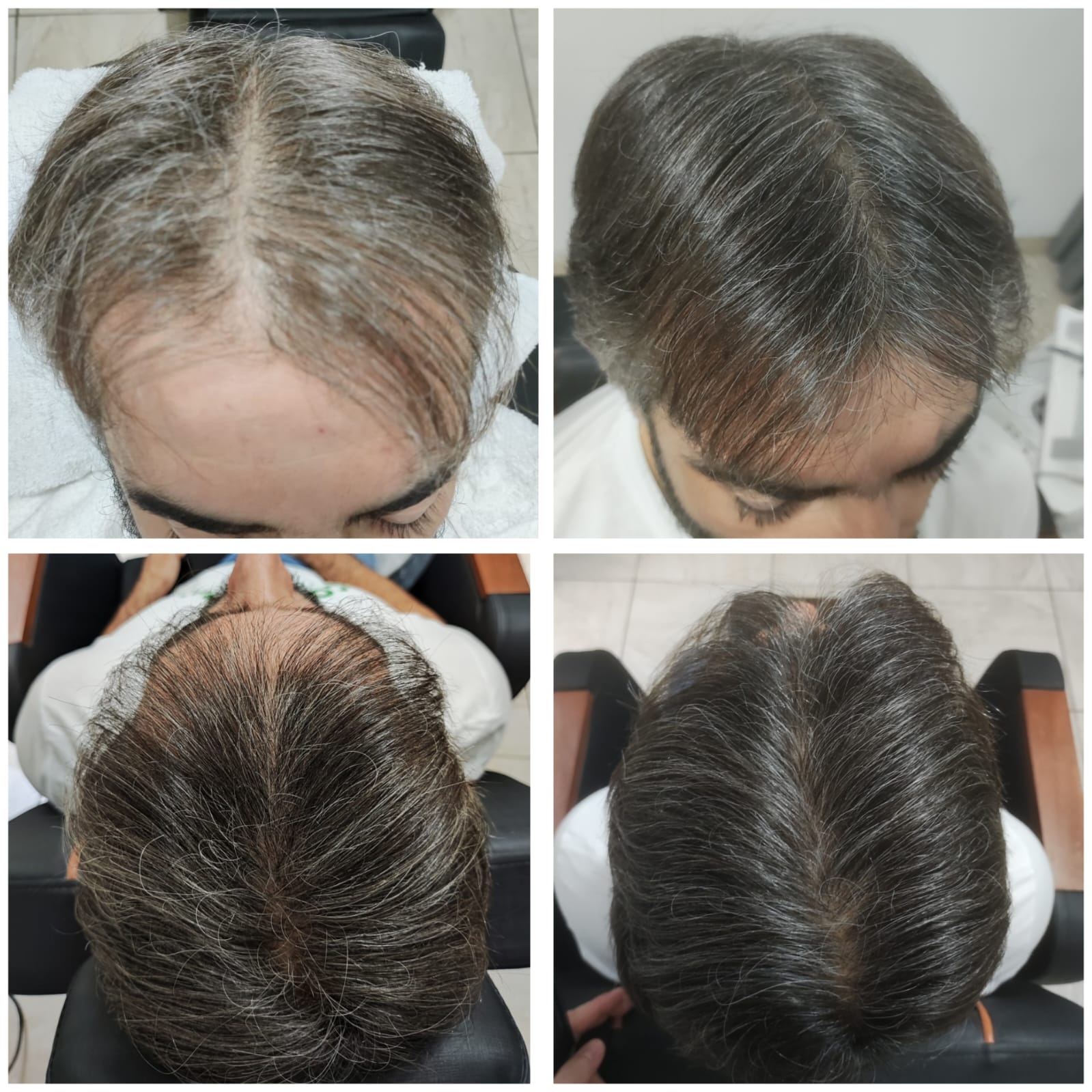 Resultado Glayson Reis