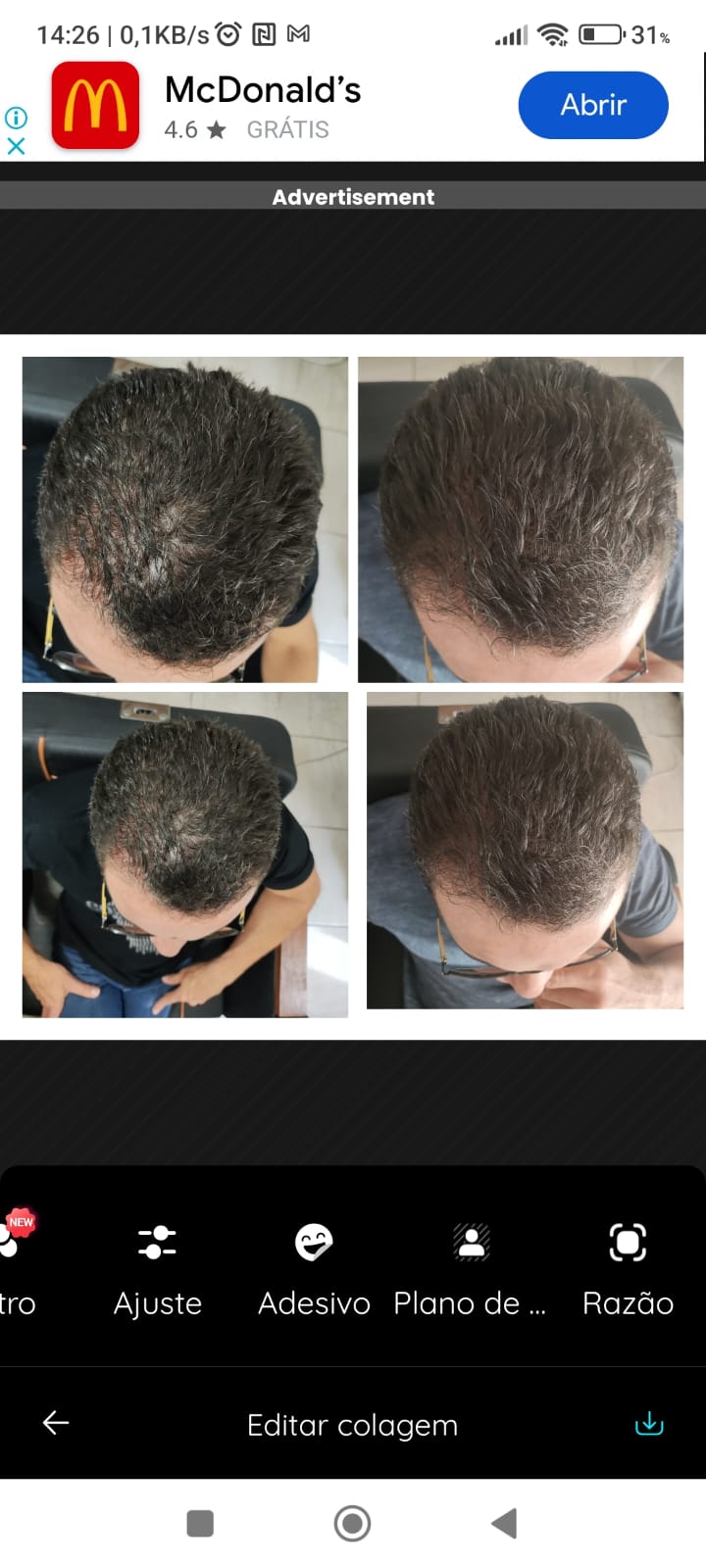 Antes e Depois