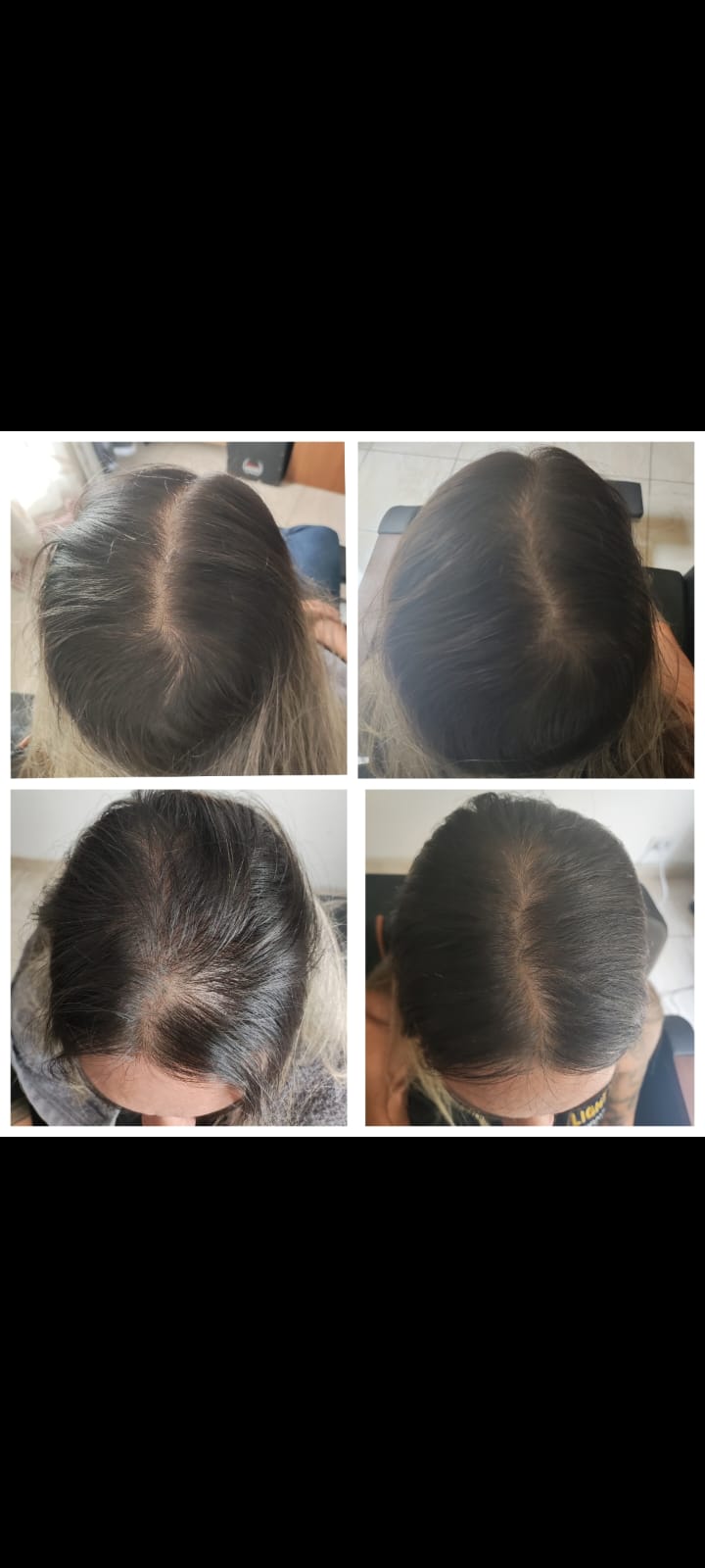 Antes e Depois